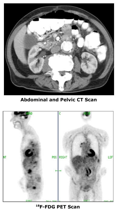 CT and PET Images