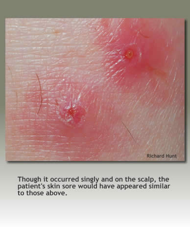 Belize skin lesions